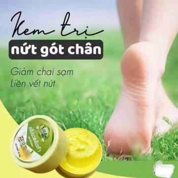 Kem Thoa Nứt Gót Chân Chuối BANANA Thailand (30g)