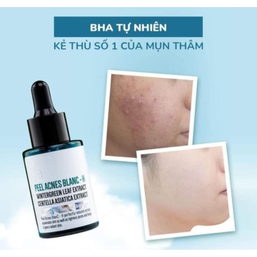 Serum Peel Lộc Đề DETOXBLANC (30ML)