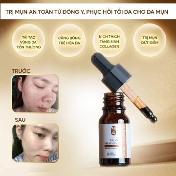 Serum Cốt Huyết Thanh Thảo Dược 36 Vị MEEA (10ML)