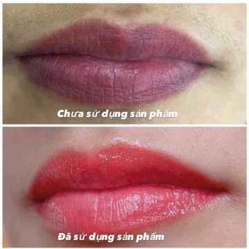 Dưỡng Collagen Kích Màu Môi Phun Xăm M&T