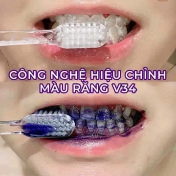 Serum Trắng Răng Thơm Miệng UNIsmile (10 ML)