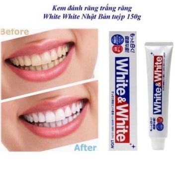 Kem Đánh Răng White & White Lion Nhật 150gr