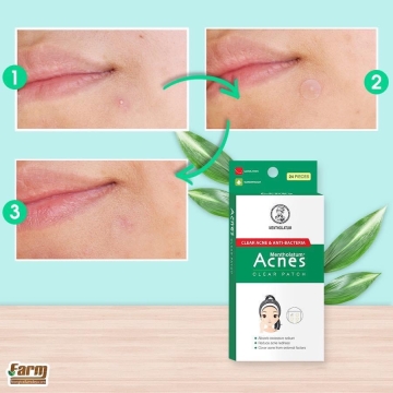 Miếng Dán Mụn Acnes CLEAR PATCH BHA 2% (H/24)