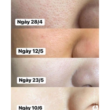 Toner OBAGI CLENZIderm M.D. Pore Therapy (148ML)