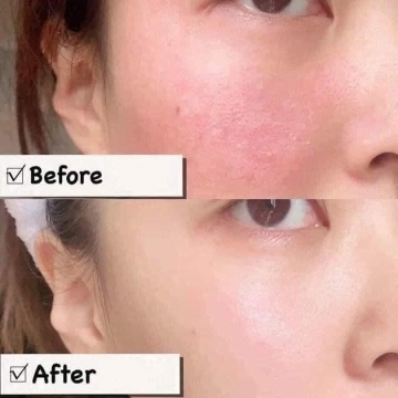 Kem Dưỡng Phục Hồi Bioderma Cicabio (Tím) 40ML