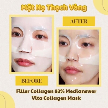 Hộp Nạ Thạch MediAnswer Vita Collagen (H/5 Mask)