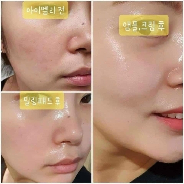 Viên Collagen Tươi Serum Multi Vita Ampoule (H/38v)