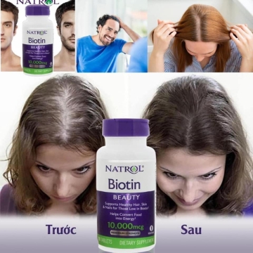 Viên Uống Mọc Tóc NATROL Biotin 10,000mcg (H/100v)