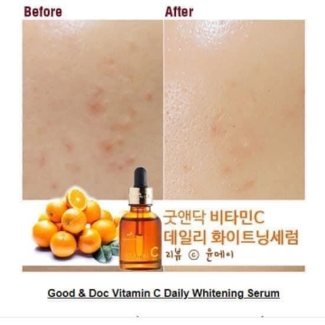 Serum Vitamin C 16.5 Daily Whitening GoodnDoc (30ML)