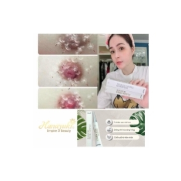 Kem Hồng Nhũ Hoa Hanayuki Pink Nipple 20Gr