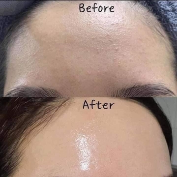 Kem Dưỡng Retinol 0,5% K Lady Care (30ML)