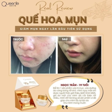Kem Mụn Quế Hoa Queenie Skin